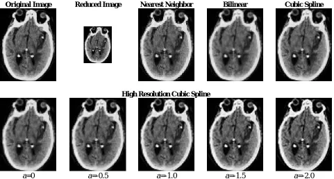 Figure 9 A CT scan image of head is reduced to 50% of its original size and then zoomed back to its original size using nearest neighbor, linear, cubic and high resolution cubic spline with a=0, -0.5, -1, -1.5 and -2 [17]