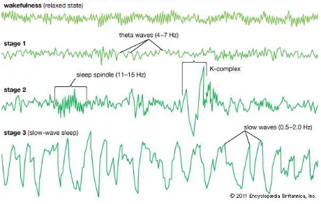 Figure 5: Characteristic EEG features for sleep stages 57