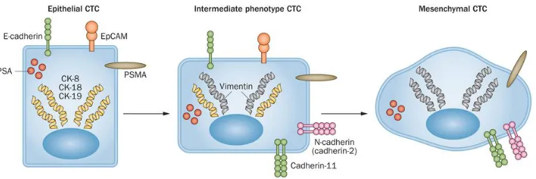 Figure 4: The transition from epithelial to mesenchymal phenotype visualized. Epithelial markers, such as EpCAM and CKs are lost, while mesenchymal markers, such as Vimentin and Cad11 are gained during the transition [10]