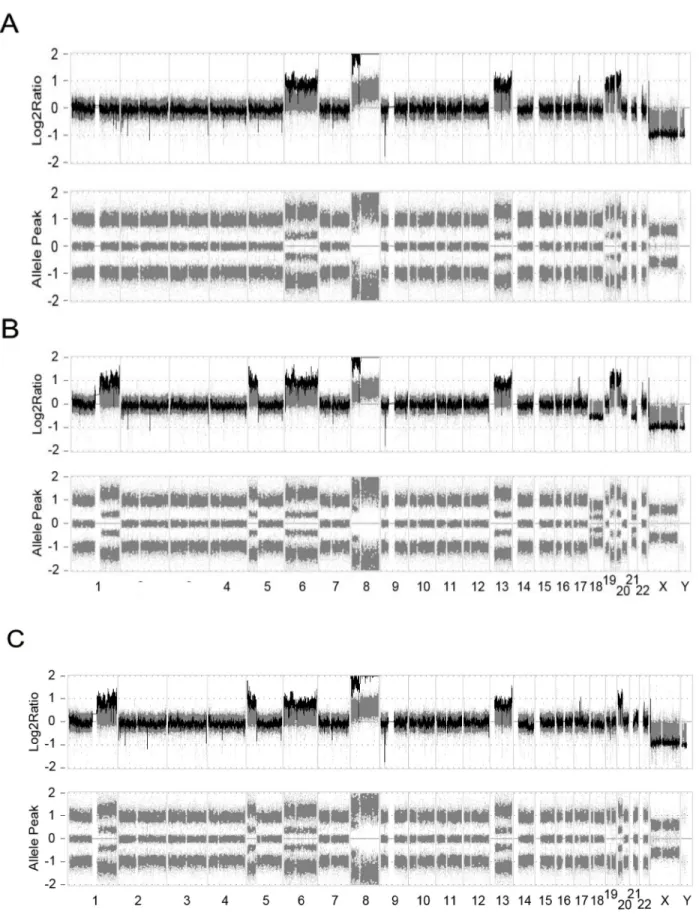 Figure 3: The log 2  ratio of array-CGH and allele peak view of SNP microarray.  The CNAs detected by array-CGH were  supported by the allele peak plots by SNP microarray