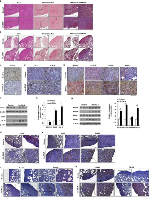 Figure 4: LOXL4 knockdown increases collagen synthesis and deposition.  A. Images of H&amp;E-, Picrosirius red-, and Masson’s  trichrome-stained sections of primary tumors resulting from injection of control and LOXL4-knockdown cells