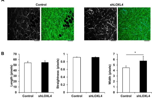 Figure 5: Second harmonic generation (SHG) imaging of control and LOXL4-knockdown primary tumor tissues.