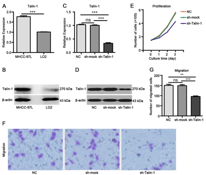 Figure 1: Talin-1 promotes HCC growth and metastasis.  Talin-1 is more highly expressed in MHCC-97L cells compared with  LO2 cells in terms of (A) mRNA levels  and (B) protein amounts