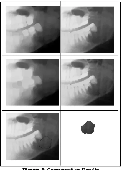 Figure 4: Segmentation Results 