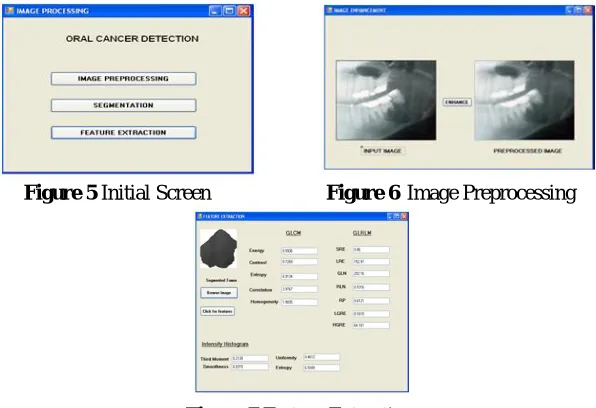 Figure 7 Feature Extraction 