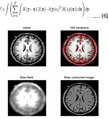 Fig. 2:  1: Original image 2: Final zero level contours of Φ1 (red), i.e. the segmentation result, 3: Estimated bias field; 4: Bias corrected images; 