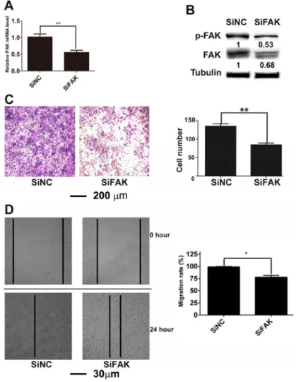 Figure 1: Down-regulation of FAK suppressed the migration of B16F10 cells.  (A) The mRNA level of FAK in SiNC and  SiFAK cells