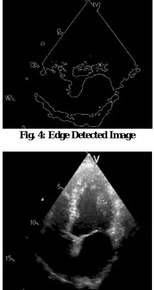 Fig. 4: Edge Detected Image  