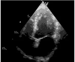 Fig. 6:  Final Output image after K-means  