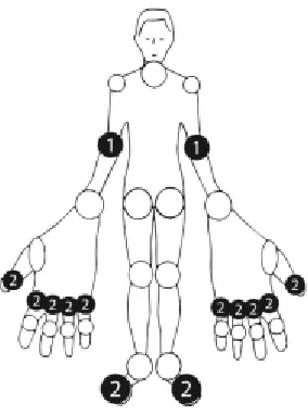 Figure 1 RAAD scoring system 