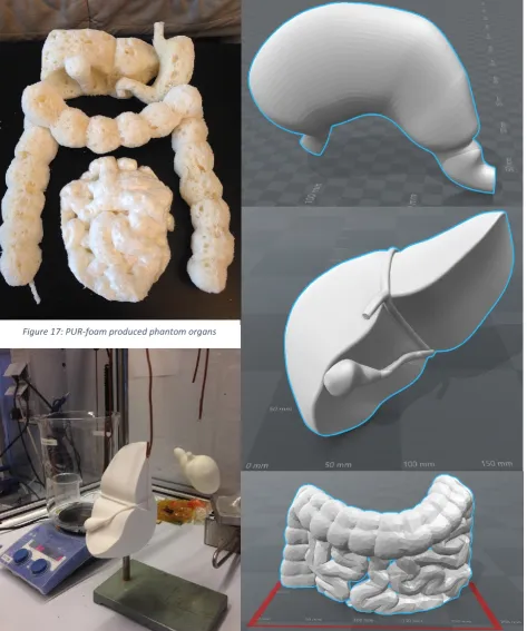 Figure 17: PUR-foam produced phantom organs 