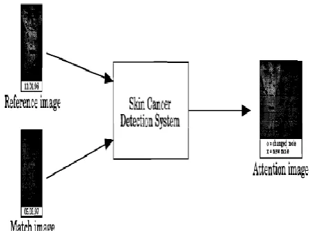 Figure 8: Skin Cancer Detection System Comparison: 