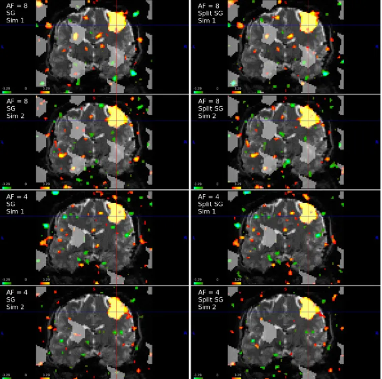 Fig. 5 . Example simulations for AF = 8 and AF = 4 for run duration = 240 s and FOV/3 shifts with scaling  factor = 1 (average percent change from baseline = 1.06%)