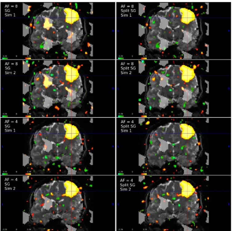 Fig. 6 . Example simulations for AF = 8 and AF = 4 for run duration = 480 s and FOV/3 shifts with scaling  factor = 5 (average percent change from baseline = 5.30%)