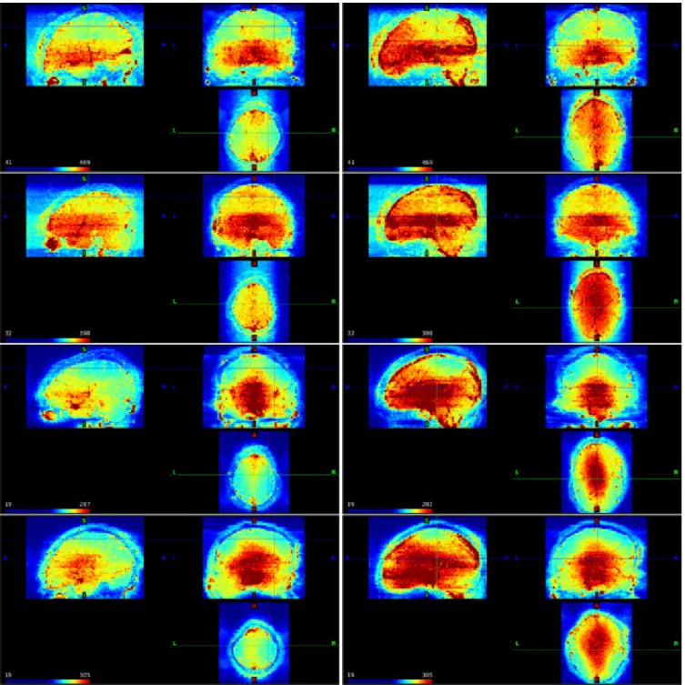 Fig. 7. The standard deviation of the residuals from the point-wise AR(3) models fit to the unprocessed  HCP motor task data from four subjects with the cursor at (63, 49, 53) (left column) and (46, 44, 37)  (right column) in scanner coordinates