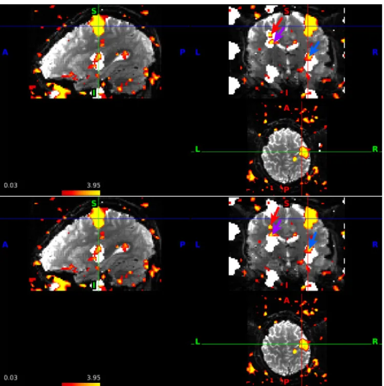 Fig. 8. An illustrative example of voxels that contribute to evidence of slice leakage using our 