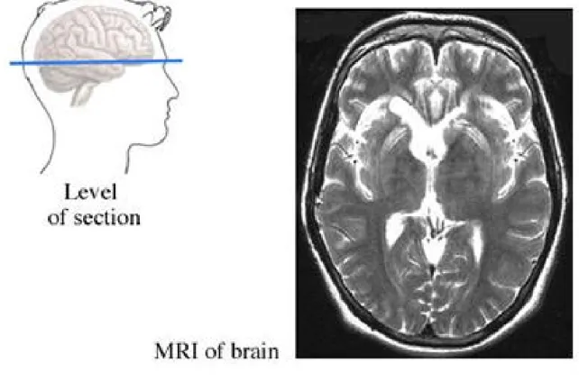 Figure 1: Single slice from a brain MRI scan [Slo13]