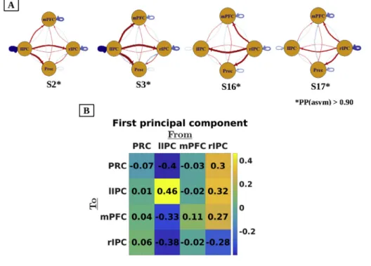 Fig. 2. Panel A: Connectivity patterns for exemplar subjects. For extrinsic connections (i.e., between  re-gions), red lines denote positive connectivity and blue lines negative connectivity