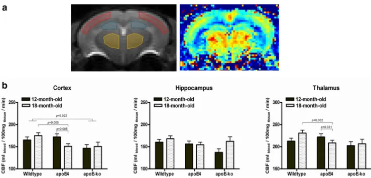 Figure 6. MD comparison between wild-type, apoE4, and apoE-KO mice. VBA indicate significant differences in MD at 12 and 18 months of age