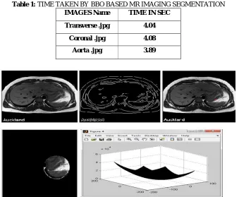 Table 1: TIME TAKEN BY BBO BASED MR IMAGING SEGMENTATION IMAGES Name TIME IN SEC 