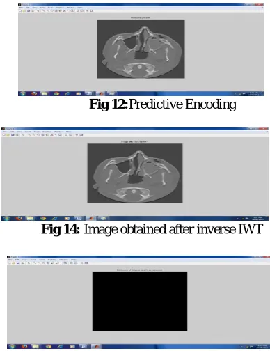Fig 11:                                   Original image of nasal fracture [19]                                               Fig 12:Predictive Encoding  
