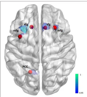 FIGURE 1 | Illustration of seeds for the seed-to-voxel functional connectivity analysis