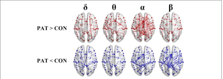 FIGURE 2 | Results of the functional resting-state source connectivity analysis with the seeds located at the Brodmann area centroids