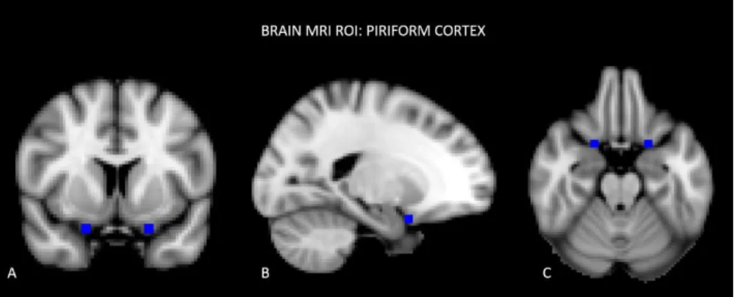 Figure 2: Brain MRI ROI Piriform Cortex   