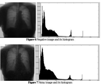 Figure 8  Filtered Image and its histogram 
