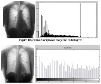 Figure 10  Contrast Manipulated image and its histogram  