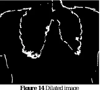 Figure 14 Dilated image  