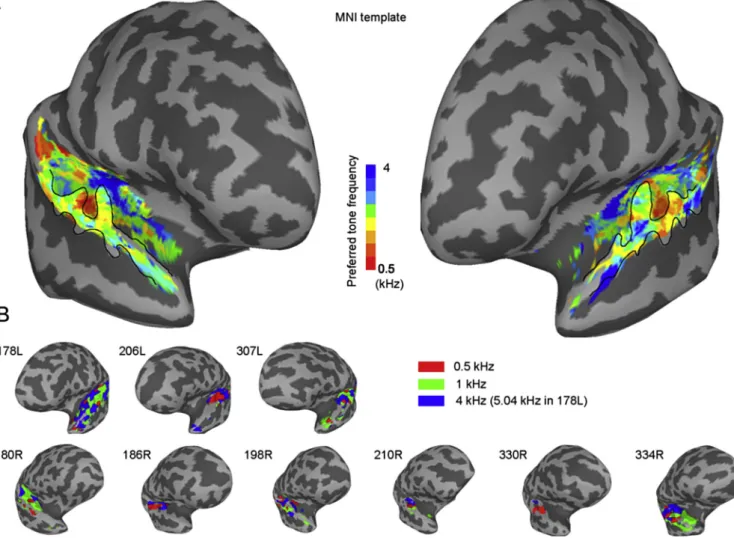 Fig. 4. fMRI activation maps. A, Group averaged BOLD preferred tone frequency maps in the superior temporal plane and superior temporal gyrus constructed from nine subjects mapped onto the template brain in the MNI space