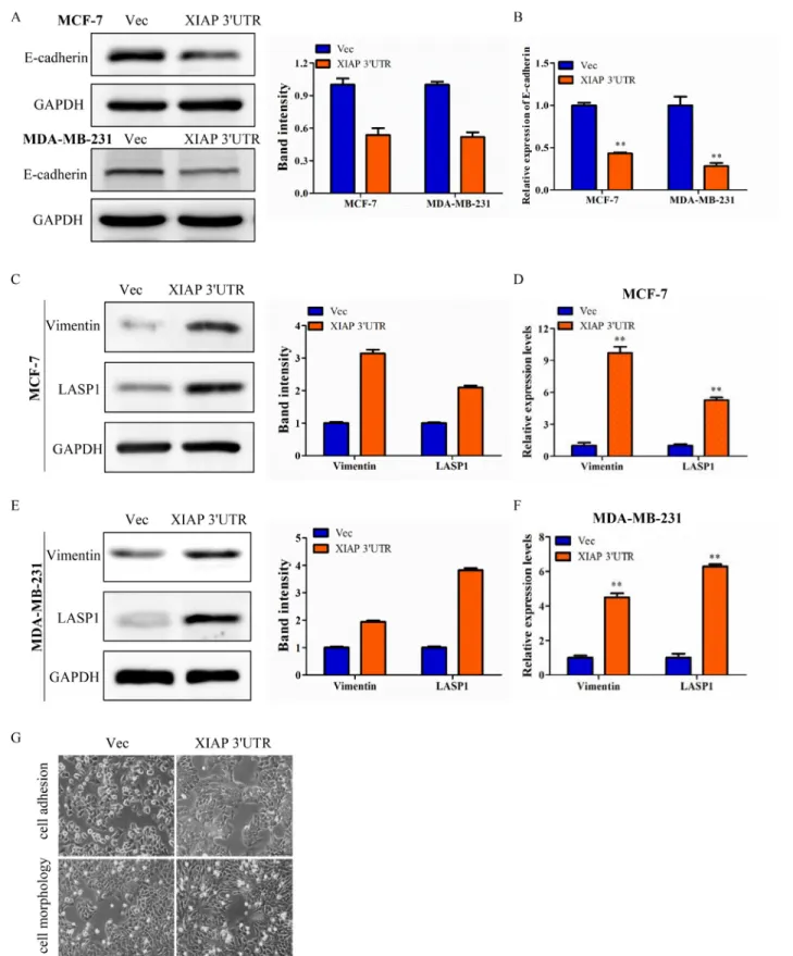 Figure 3: XIAP 3′UTR was associated with EMT features of breast cancer.  (A) Western blot analysis of MCF-7 and MDA- MDA-MB-231 for E-cadherin protein expression after transfection with XIAP 3′UTR