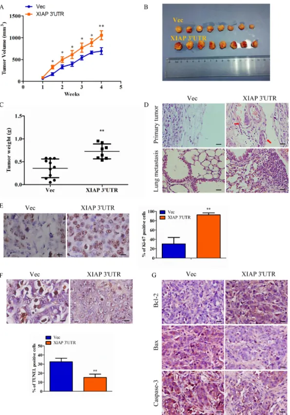 Figure 4: Expression of XIAP 3′UTR enhances tumor growth and metastasis in vivo.  (A–B) MCF-7 cells transfected with  XIAP 3′UTR or the control vector were injected subcutaneously into BALB/c nude mice