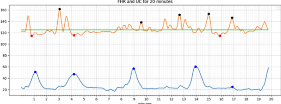 Figure 4.5. Baseline Estimation for 20 min window 