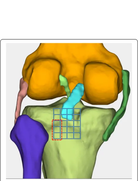 Fig. 1 Abaqus finite element analysis software is used to mesh the three-dimensional geometric model of the knee joint