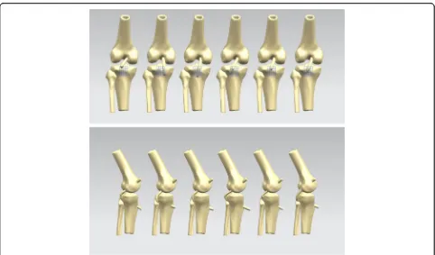 Fig. 4 In the genuflex model with 90° flexion, a posterior tibial load of 134 N was applied to the proximal tibia at different knee flexion