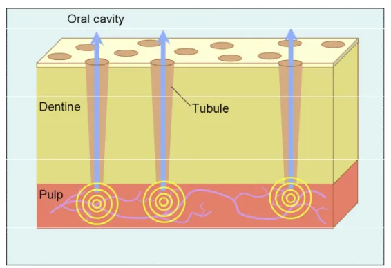 Figure 3.01: Schematic to demonstrate the hydrodynamic theory of dentinal hypersensitivity 