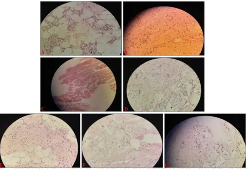 FIG. 2: HISTOLOGICAL EVALUATION OF ANTI-INFLAMMATION EFFECTS OF METHANOLIC EXTRACT OF E 