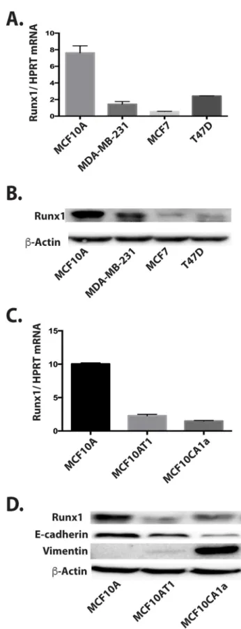Figure 1: Decreased Runx1 expression is related to breast cancer progression in cell models
