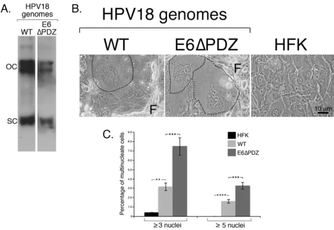 Figure 1: Loss of E6 PBM function is associated with enhanced frequency of nuclear atypia of viral genome-containing  cells