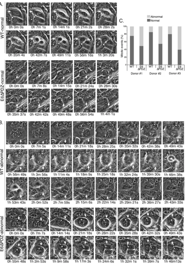 Figure 2: Live cell microscopy shows that loss of E6 PBM function is associated with an increase in abnormal mitoses  in viral genome-containing cells