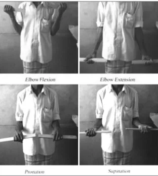 Fig. 3: Functional outcome. Patient demonstrating various movements