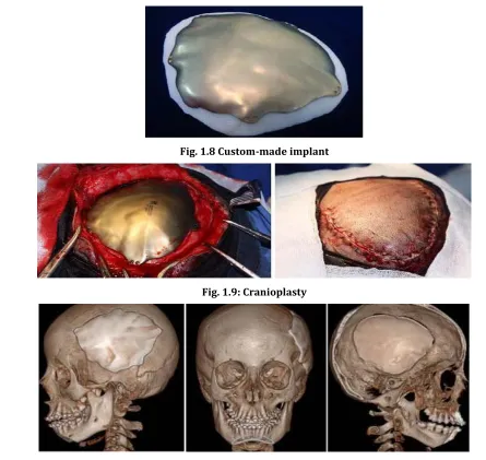 Fig. 1.10: Patient postoperative after four months 