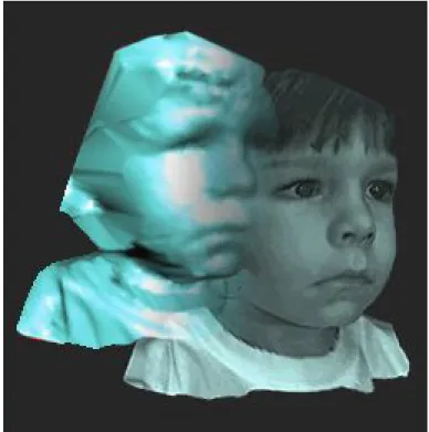 Figure 4 shows an example from the 3dmd web page (2002) showing a rendered solid colored object and then one with the texture of the face placed over it generated using 3Q technology