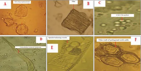 TABLE 1: MEASURE OF DISCRIMINATION Microscopic  Dimension 