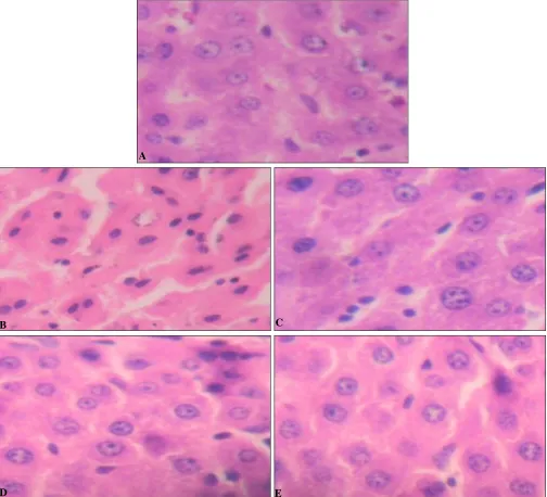 FIG. 5: HISTOPATHOLOGICAL EXAMINATION FOR THE HEPATOPROTECTIVE ACTIVITY OF D 