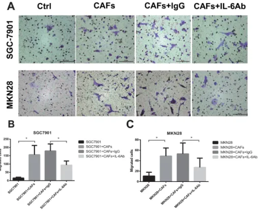 Figure 2: CAFs enhance the migration of gastric cancer cells via the secretion of IL-6
