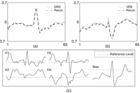 Fig. 2. Reconstruction by the trained CRBM with input of (a) a normal QRS and (b) a typical VEB