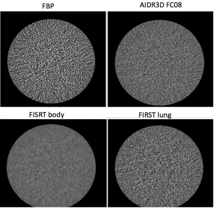 Figure 4. Catphan phantom images (1mm slices) of the three reconstruction techniques: FBP, AIDR3D and FIRST